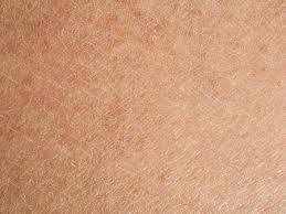 gallery-image-background-0